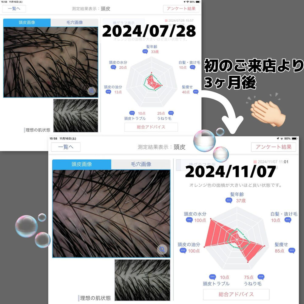 ブログ
